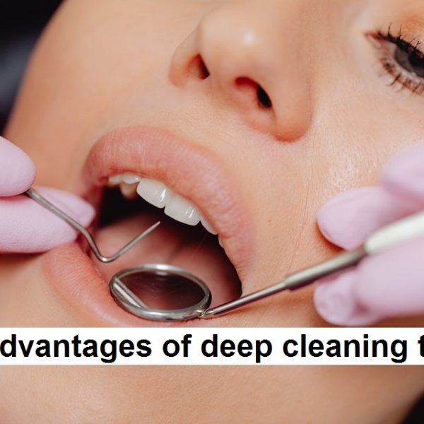 Disadvantages of deep cleaning teeth