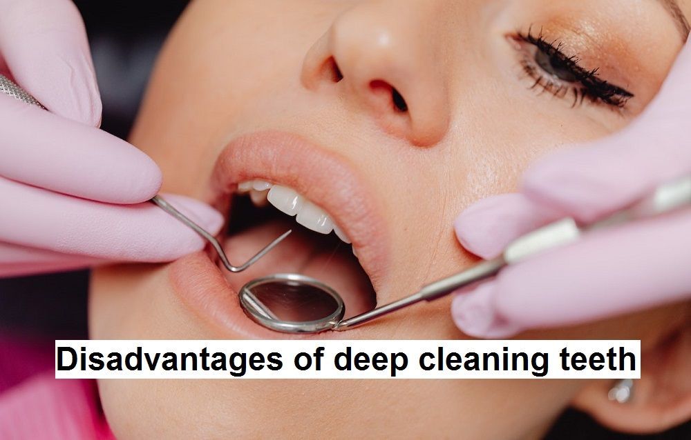 Disadvantages of deep cleaning teeth