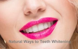 Natural Teeth Whitening