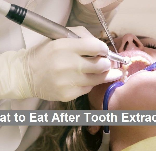 What to Eat After Tooth Extraction
