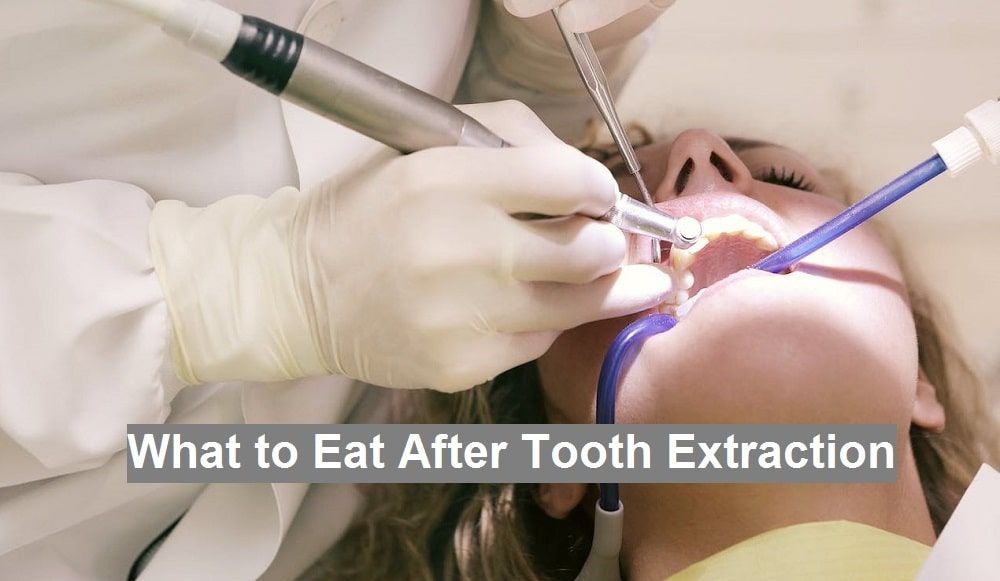 What to Eat After Tooth Extraction